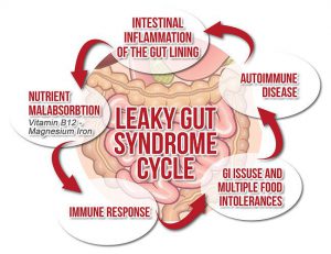 Leaky Gut – What, Why, How