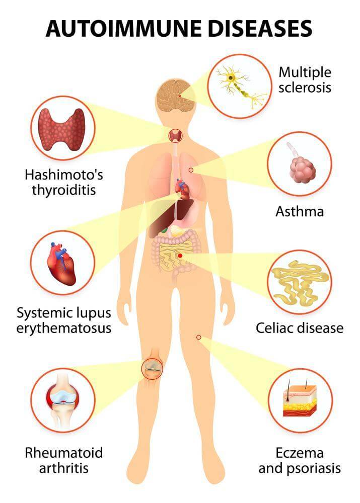 Colostrum for Autoimmune Diseases – BodyBoost Colostrum